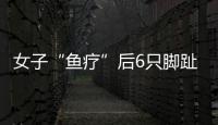 女子“魚療”后6只腳趾甲脫落！大保健千萬別再這樣做了