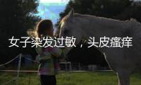 女子染發過敏，頭皮瘙癢、滲液不止，醫生：過敏者應盡量減少或避免染發