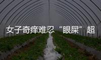 女子奇癢難忍“眼屎”超多  放大觀察居然是長了虱子