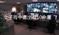 女子胃中查出有10余厘米蛔蟲