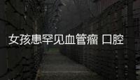 女孩患罕見血管瘤 口腔“破”了出血3斤
