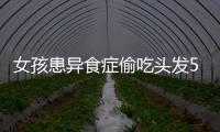 女孩患異食癥偷吃頭發5年 2斤發團纏滿胃