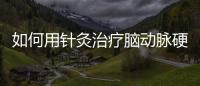 如何用針灸治療腦動脈硬化癥 中醫針灸治療腦動脈硬化癥的方法