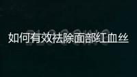 如何有效祛除面部紅血絲？