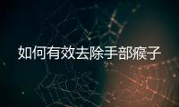 如何有效去除手部瘊子