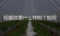 妊娠紋是什么樣的？如何預防和緩解？