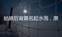 姑娘后背莫名起水泡，原來是它在作怪……