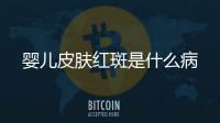 嬰兒皮膚紅斑是什么病
