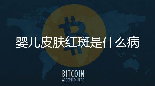 嬰兒皮膚紅斑是什么病