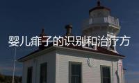 嬰兒痱子的識別和治療方法詳解