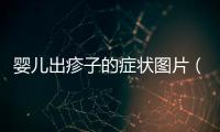 嬰兒出疹子的癥狀圖片（常見嬰兒皮膚問題及解決方法）