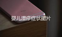 嬰兒濕疹癥狀圖片