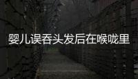 嬰兒誤吞頭發后在喉嚨里打結 切除被綁死部分