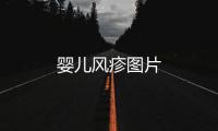 嬰兒風疹圖片
