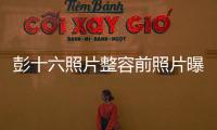 彭十六照片整容前照片曝光 彭十六臉上整了哪些地方