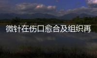 微針在傷口愈合及組織再生中的應用都有哪些呢？