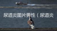 尿道炎圖片男性（尿道炎圖片）