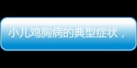 小兒雞胸病的典型癥狀，早發現早治療很重要！