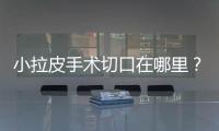 小拉皮手術切口在哪里？可以維持多久？科普知識一文了解！