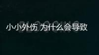 小小外傷 為什么會導致引來牛皮癬