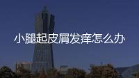 小腿起皮屑發(fā)癢怎么辦