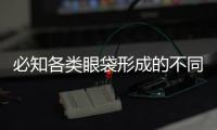 必知各類眼袋形成的不同因素