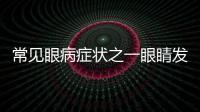 常見(jiàn)眼病癥狀之一眼睛發(fā)癢的原因與治療方法