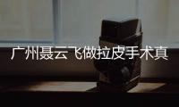 廣州聶云飛做拉皮手術真實實例:做面部smas拉皮成效好,恢復期短靠譜