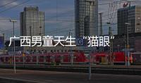 廣西男童天生“貓眼”  具有夜視能力