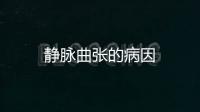 靜脈曲張的病因