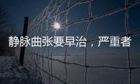 靜脈曲張要早治，嚴重者會致命，學會四個動作可預防！