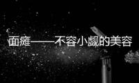 面癱——不容小覷的美容殺手