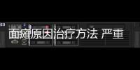 面癱原因治療方法 嚴(yán)重的患者要進(jìn)行手術(shù)治療