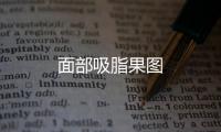 面部吸脂果圖