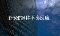 針灸的4種不良反應