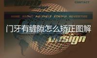 門牙有縫隙怎么矯正圖解（門牙有縫隙怎么矯正）