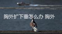 胸外擴下垂怎么辦 胸外擴下垂做什么運動