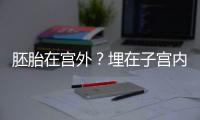 胚胎在宮外？埋在子宮內(nèi)的這顆“定時(shí)炸彈”，為何醫(yī)生勸你別小覷