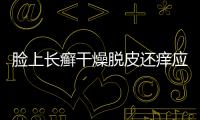 臉上長癬干燥脫皮還癢應該如何回事