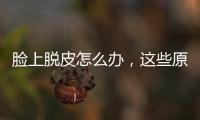 臉上脫皮怎么辦，這些原因會導致臉脫皮
