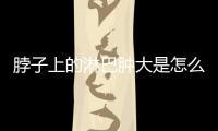 脖子上的淋巴腫大是怎么回事？如何快速緩解淋巴結腫脹？