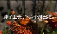 脖子上長了5六個淋巴結應該如何回事