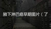 腋下淋巴癌早期圖片（了解淋巴癌早期癥狀及檢查方法）