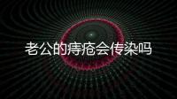 老公的痔瘡會傳染嗎