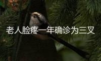 老人臉疼一年確診為三叉神經(jīng)痛 中醫(yī)藥巧祛痛