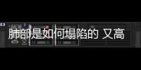 肺部是如何塌陷的 又高又瘦竟是誘因
