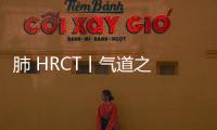 肺 HRCT丨氣道之 [Wegener肉芽腫病]