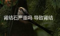 腎結石嚴重嗎 導致腎結石的原因有這些