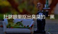 肚臍眼里摳出臭臭的“黑泥”，到底是啥？真實答案有點重口味