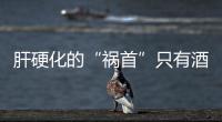 肝硬化的“禍首”只有酒？提醒：這個原因傷肝也不少，但易被忽視